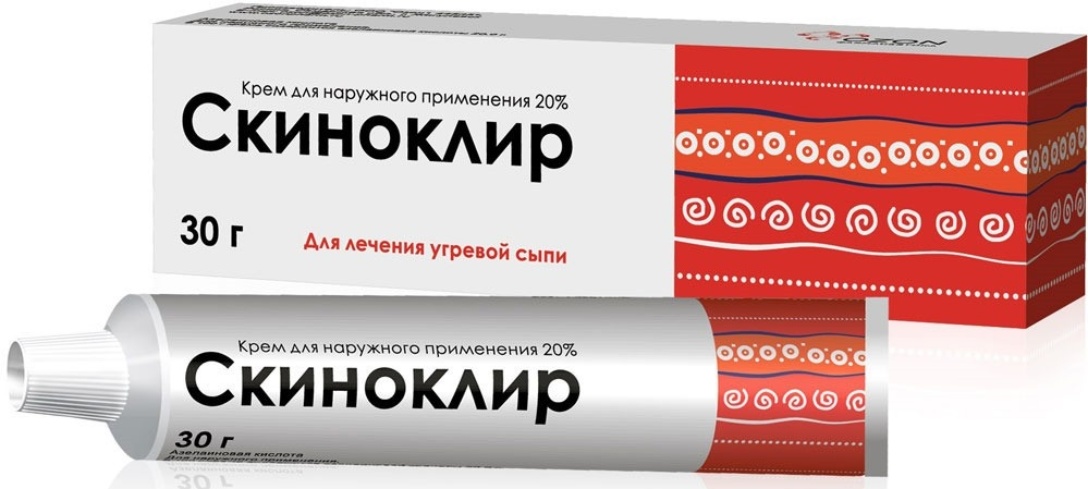 Отзыв о Крем для лечения угревой сыпи Озон "Скиноклир" Избавляет от угревой сыпи