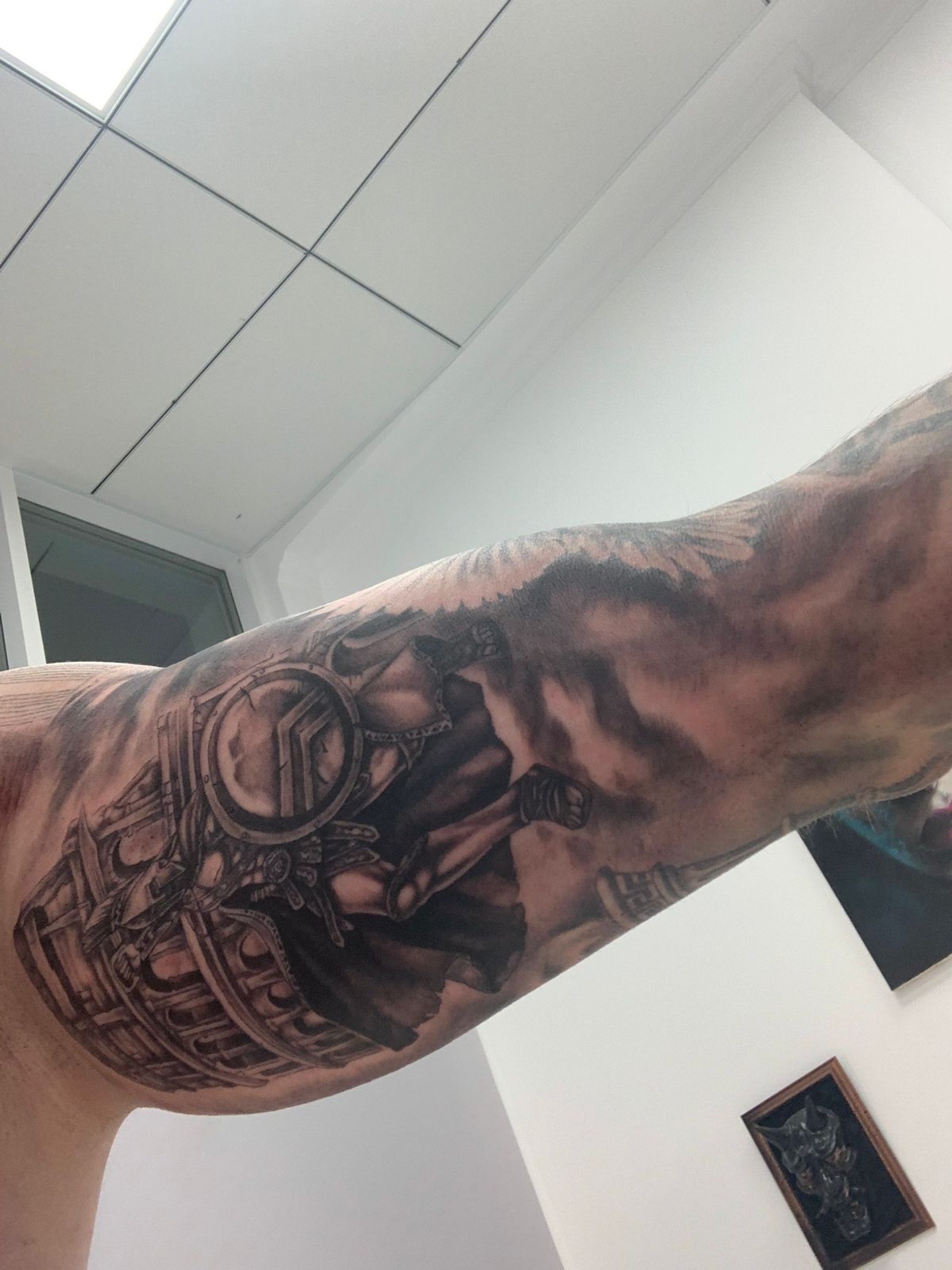 Лазерное удаление татуировок в Белгороде