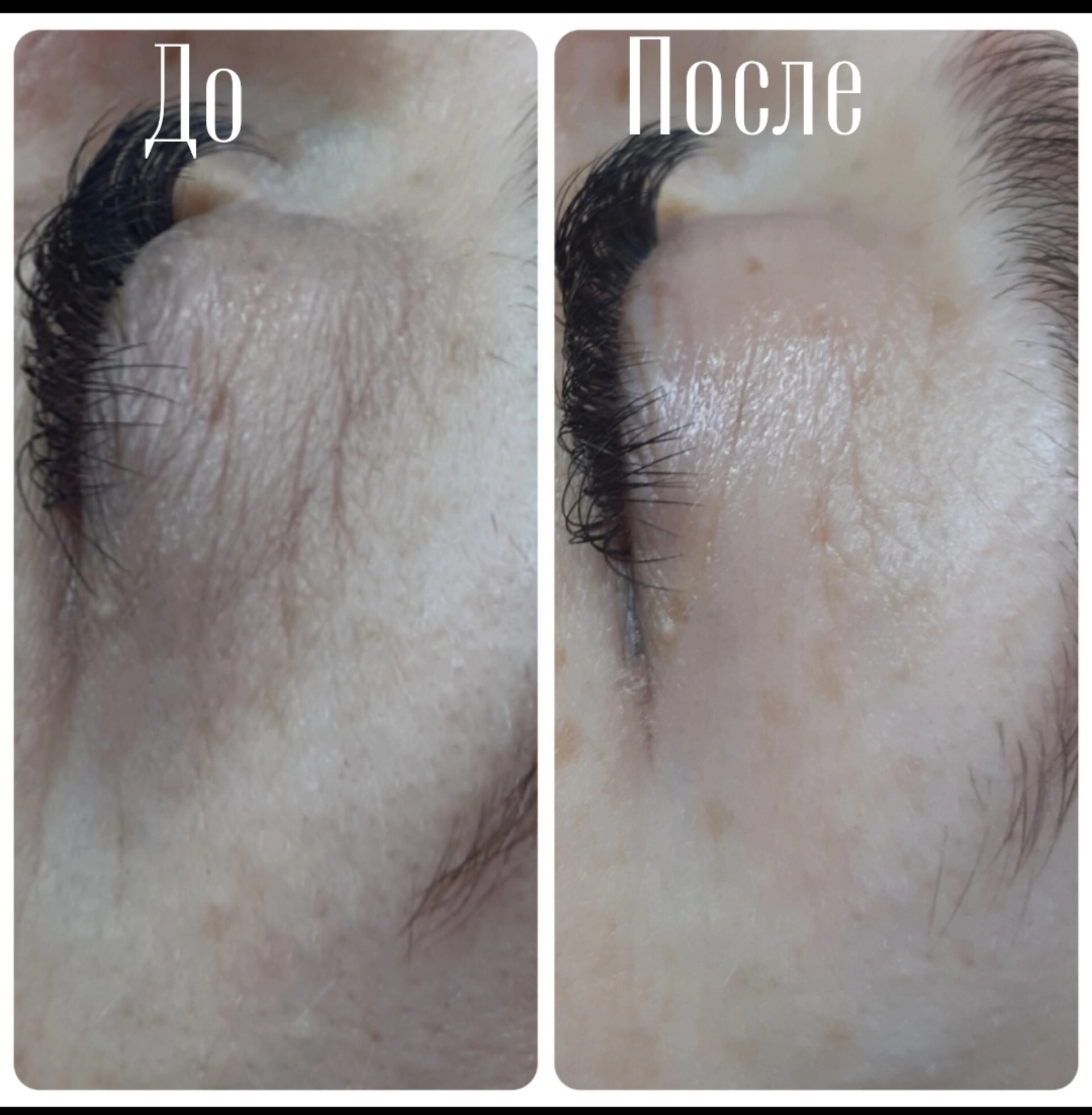 наталья кошлина