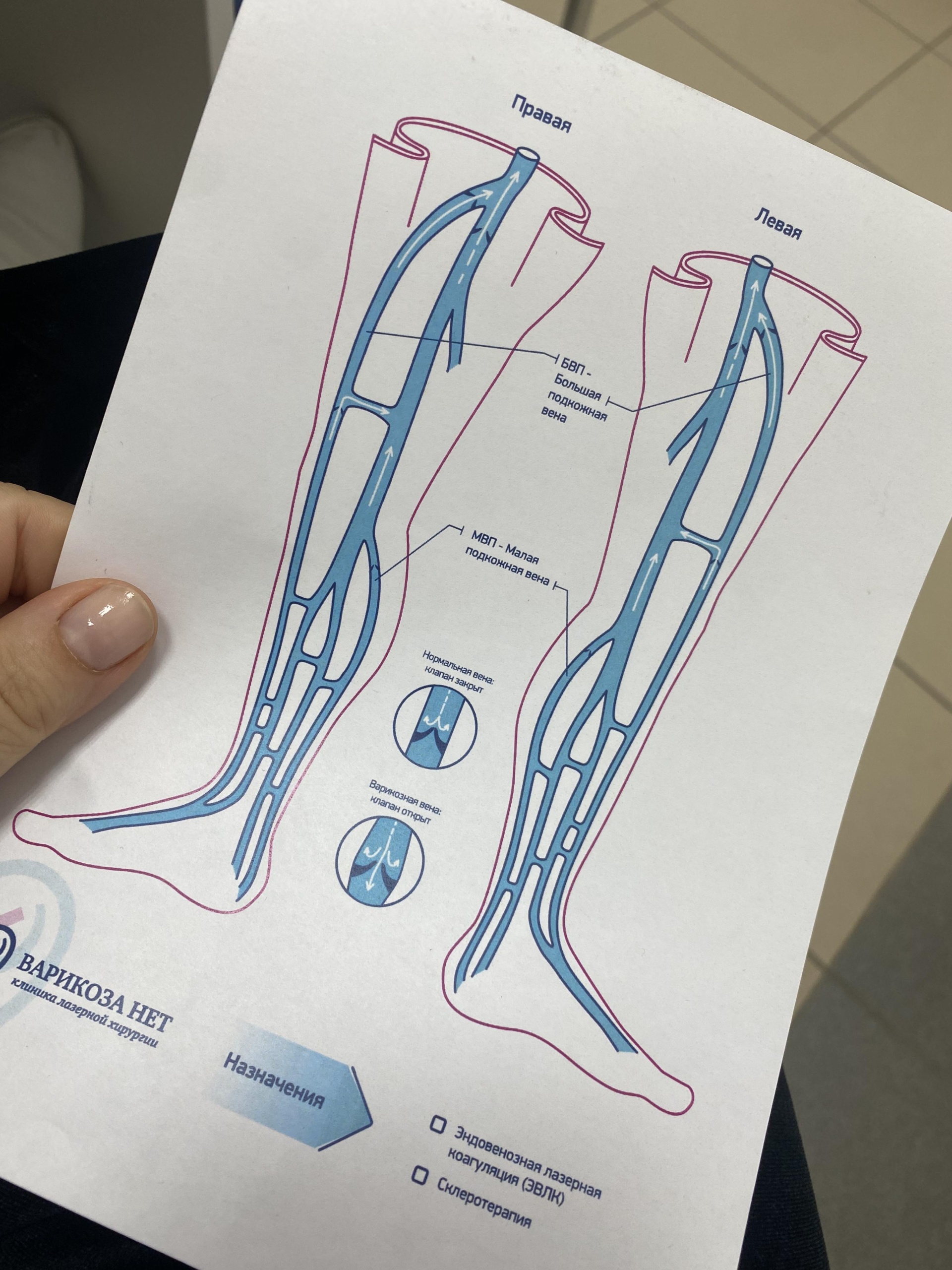 Варикоза нет, клиника лазерной хирургии, площадь Димитрова, 3 к2, Рязань —  2ГИС